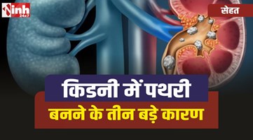 Kidney Stones : किडनी में कैसे बनती है पथरी, क्या है तीन बड़े करण? 