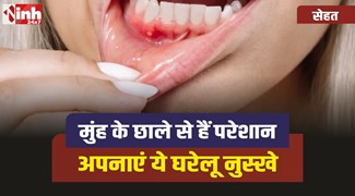 Muh ke Chale :  मुंह के छालों से हैं परेशान, तो अपनाएं ये 3 घरेलू नुस्खे