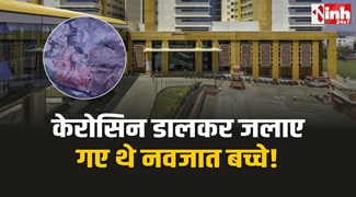 Hamidia Hospital : केरोसिन डालकर जलाए गए थे हमीदिया में मिले नवजात बच्चे