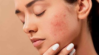 Pimples Ka Gharelu llaj:  प‍िंपल्‍स ने अगर बिगाड़ दी है चेहरे की रंगत, तो अपनाएं ये घरेलू नुस्‍खे, त्वचा हो जाएगी ग्लोइंग और चमकदार