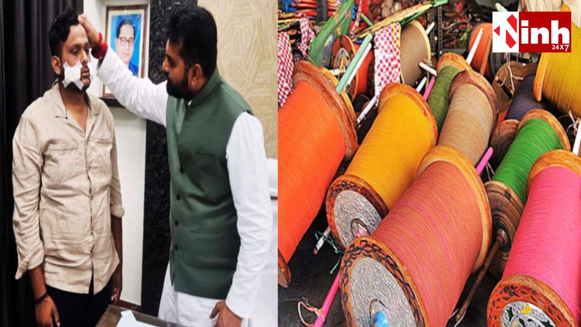 चाइनीज मांझे से युवक गंभीर घायल, चेहरे पर लगे 34 टांके, प्रतिबंध के बावजूद खुलेआम बिक्री पर उठा सवाल...  