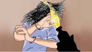 GWALIOR NEWS : ग्वालियर में पति ने पत्नी पर किया एसिड अटैक, 4 महीने की बच्ची भी झुलसी, इलाज जारी 