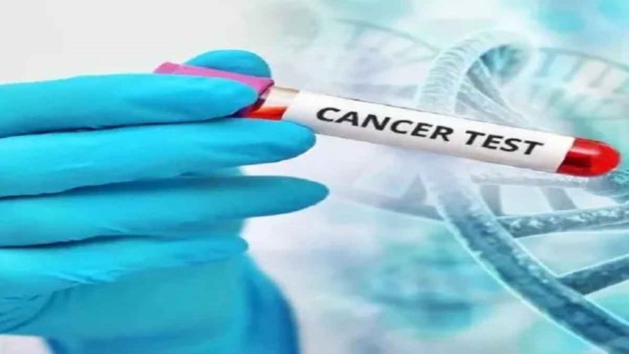 अब कैंसर का इंजेक्शन मरीजों को मिलेगा मुफ्त, तैयारी शुरू, 1.70 लाख तक है कीमत 