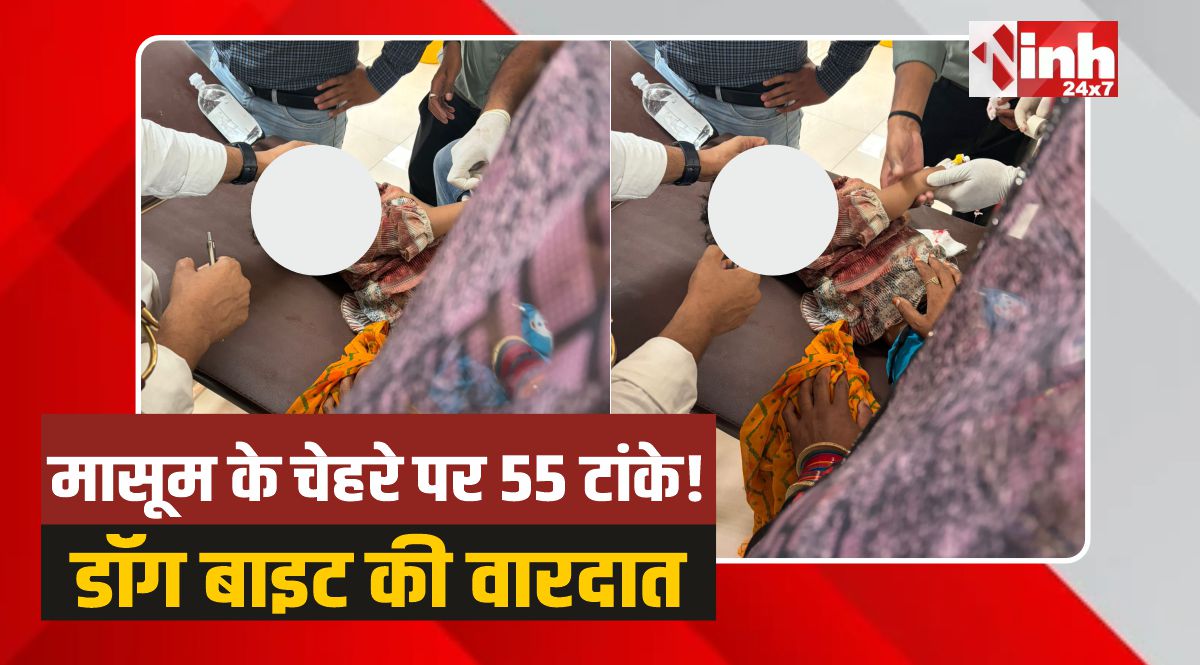 Agar Malwa: आगर मालवा में डॉग बाइट की रोंगटे खड़े करने वाली वारदात, बच्ची का चेहरा नोचा