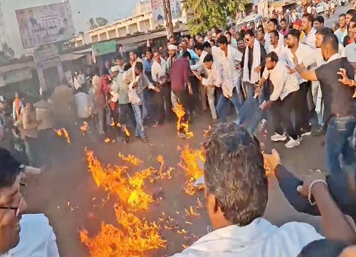 कांग्रेस के पुतला दहन के दौरान भड़की आग, कई कार्यकर्ता चपेट में